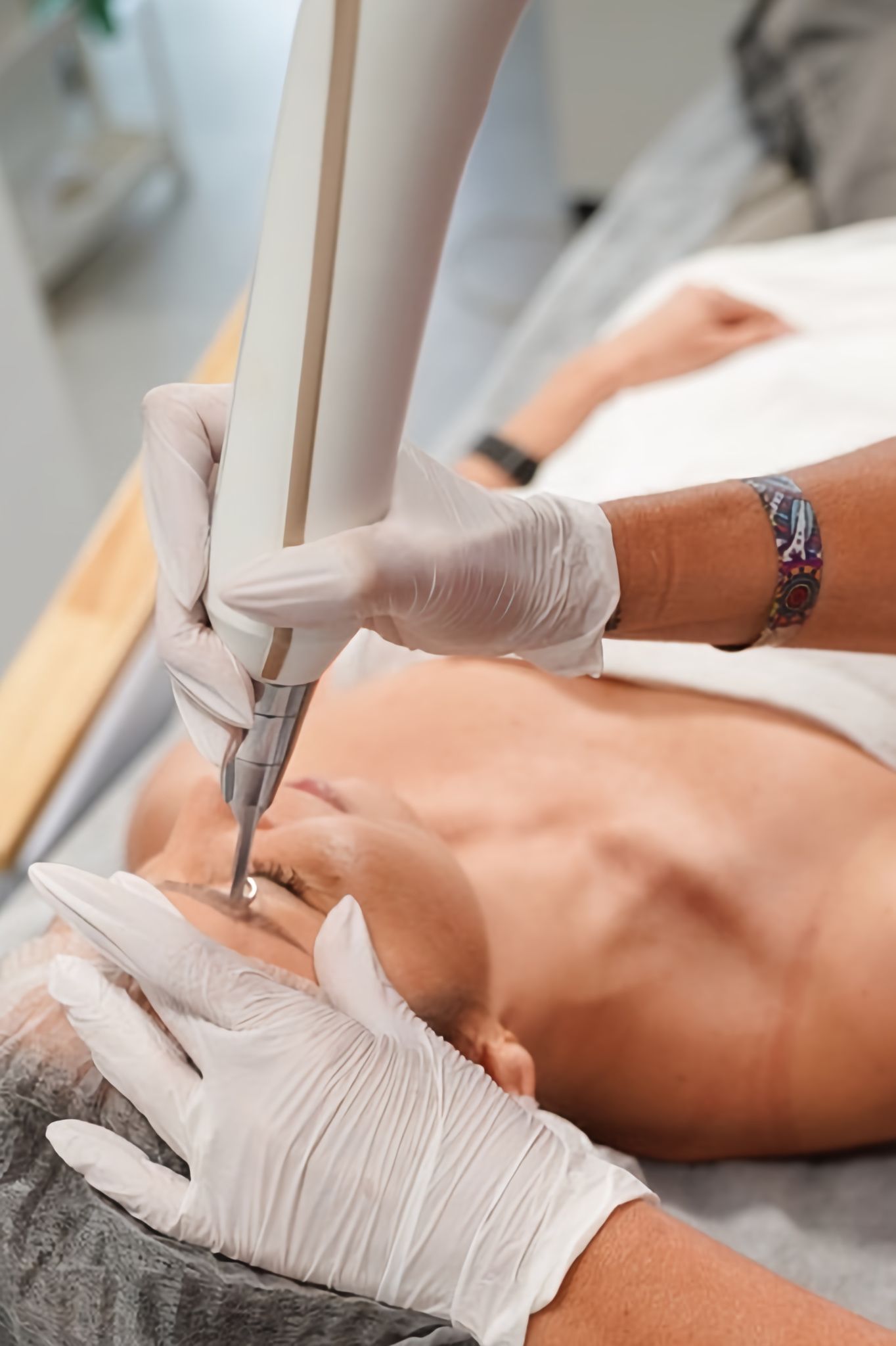 Usuwanie Permanentu i Tatuaży